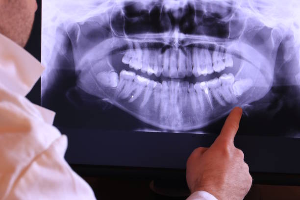 Best Emergency Tooth Extraction in Hernando, FL