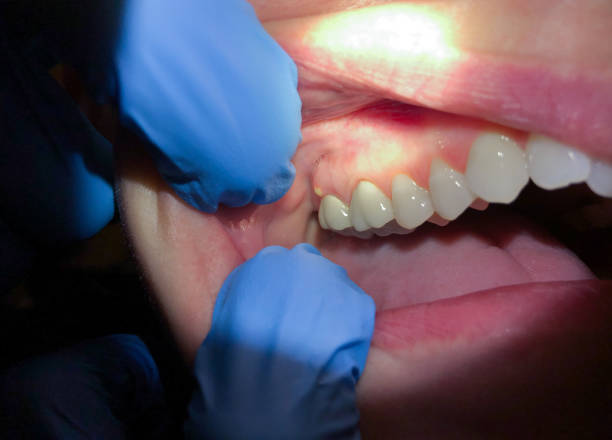 Best Cosmetic Emergency Dentistry in Hernando, FL